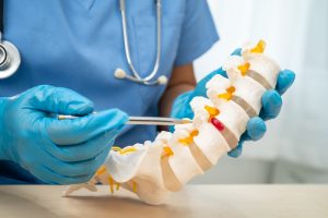 DEGENERATIVE DISC DISEASE TREATMENT